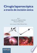 Libro Cirugía laparoscópica a través de incisión única