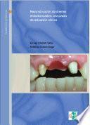 Libro Reconstrucción de dientes endodonciados